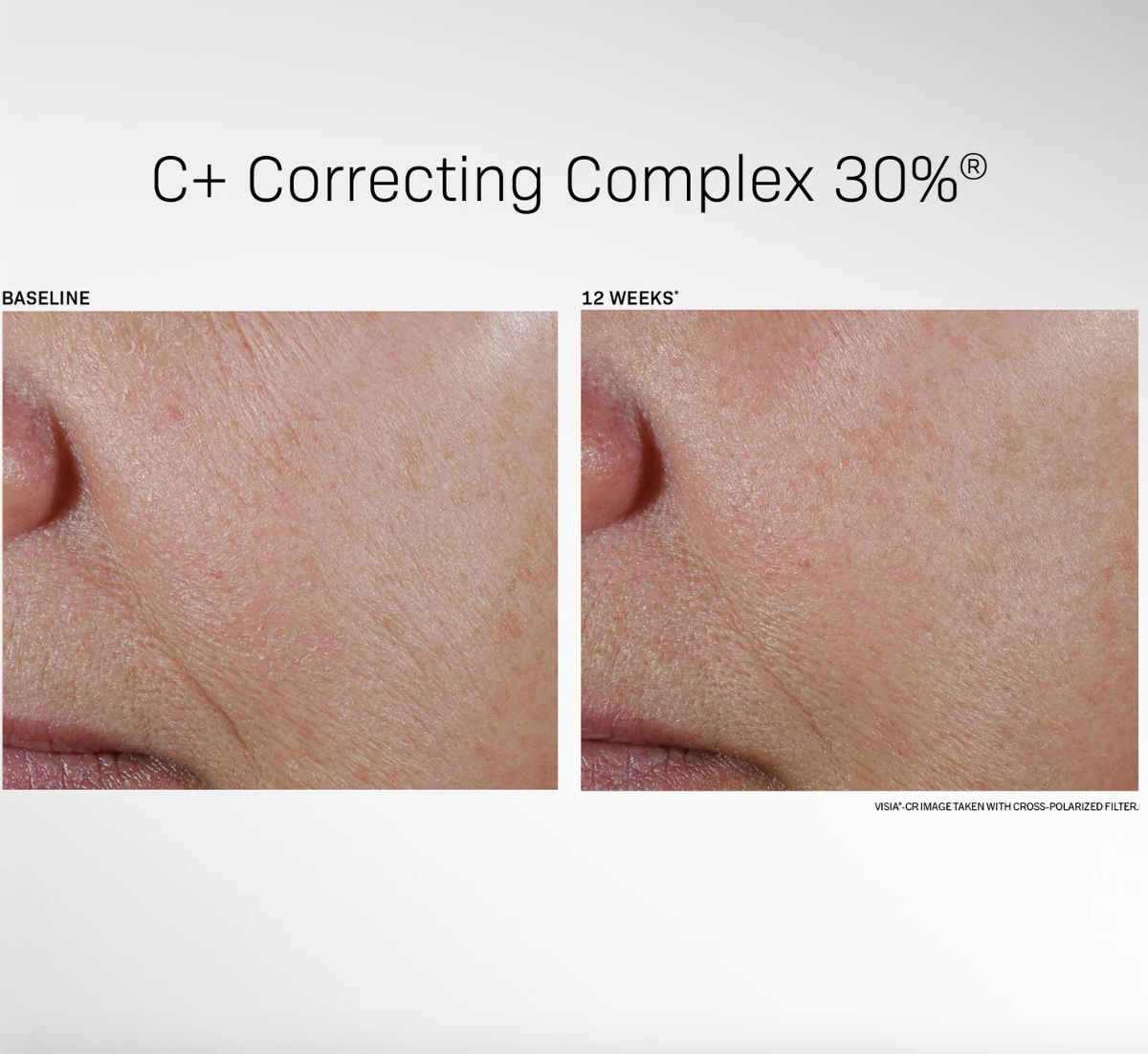 C+ Correcting Complex 30%® 1 fl oz